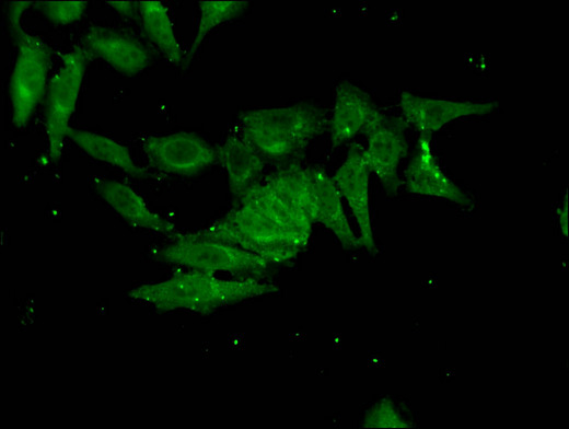 FHL5 Antibody - Immunofluorescent analysis of Hela cells using FHL5 Antibody at a dilution of 1:100 and Alexa Fluor 488-congugated AffiniPure Goat Anti-Rabbit IgG(H+L)
