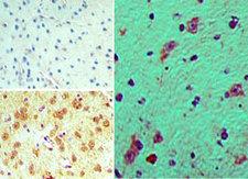 FHOD3 / FHOS2 Antibody - IHC of FHOD3 in formalin-fixed, paraffin-embedded mouse brain tissue using an isotype control (top left) and Peptide-affinity Purified Polyclonal Antibody to FHOD3 (bottom, right) at 15 ug/ml.