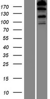 FHOD3 / FHOS2 Protein - Western validation with an anti-DDK antibody * L: Control HEK293 lysate R: Over-expression lysate