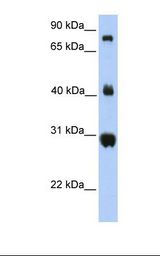 FIBCD1 Antibody - Fetal lung lysate. Antibody concentration: 1.0 ug/ml. Gel concentration: 12%.  This image was taken for the unconjugated form of this product. Other forms have not been tested.