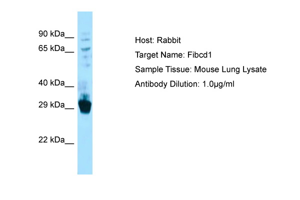 FIBCD1 Antibody -  This image was taken for the unconjugated form of this product. Other forms have not been tested.