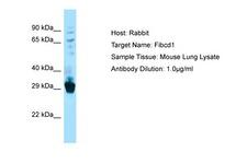 FIBCD1 Antibody -  This image was taken for the unconjugated form of this product. Other forms have not been tested.