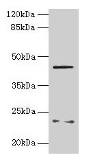 FIBP Antibody - Western blot All lanes: FIBP antibody at 6µg/ml + MCF-7 whole cell lysate Secondary Goat polyclonal to rabbit IgG at 1/10000 dilution Predicted band size: 42 kDa Observed band size: 42 kDa