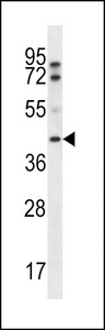 FIBP Antibody - FIBP Antibody western blot of A2058 cell line lysates (35 ug/lane). The FIBP antibody detected the FIBP protein (arrow).