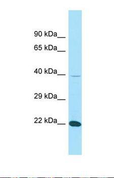FIBP Antibody - Western blot of Human THP-1. FIBP antibody dilution 1.0 ug/ml.  This image was taken for the unconjugated form of this product. Other forms have not been tested.