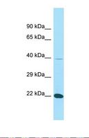 FIBP Antibody - Western blot of Human THP-1. FIBP antibody dilution 1.0 ug/ml.  This image was taken for the unconjugated form of this product. Other forms have not been tested.