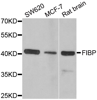 FIBP Antibody - Western blot analysis of extracts of various cell lines.
