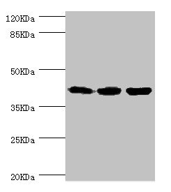 FIBP Antibody - Western blot All Lanes:FIBP antibody at 1.84ug/ml Lane 1:rat gonad tissue Lane 2:MCF-7 whole cell lysate Lane 3:mouse skeletal muscle tissue Secondary Goat polyclonal to rabbit at 1/10000 dilution Predicted band size: 42kDa Observed band size: 42kDa