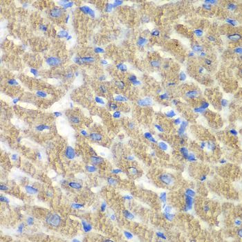 FIBP Antibody - Immunohistochemistry of paraffin-embedded mouse heart using FIBP antibody at dilution of 1:100 (40x lens).