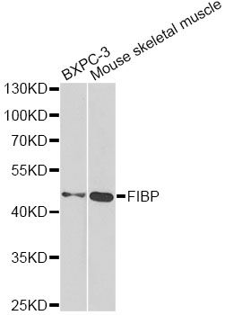 FIBP Antibody - Western blot analysis of extracts of various cell lines, using FIBP antibody at 1:1000 dilution. The secondary antibody used was an HRP Goat Anti-Rabbit IgG (H+L) at 1:10000 dilution. Lysates were loaded 25ug per lane and 3% nonfat dry milk in TBST was used for blocking. An ECL Kit was used for detection and the exposure time was 90s.
