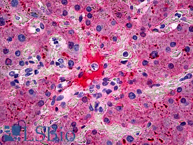 Fibrinogen Antibody - Anti-Fibrinogen antibody IHC of human liver. Immunohistochemistry of formalin-fixed, paraffin-embedded tissue after heat-induced antigen retrieval. Antibody concentration 5 ug/ml.