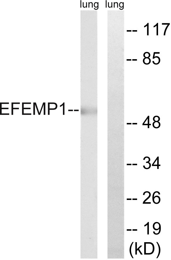 Fibulin-3 / EFEMP1 Antibody - Western blot analysis of lysates from rat lung, using EFEMP1 Antibody. The lane on the right is blocked with the synthesized peptide.