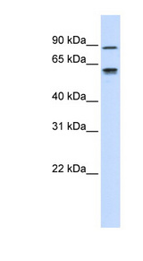 Fibulin-3 / EFEMP1 Antibody - EFEMP1 antibody Western blot of Placenta lysate. This image was taken for the unconjugated form of this product. Other forms have not been tested.