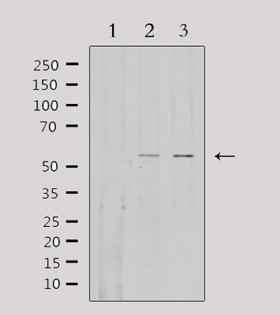 Fibulin-3 / EFEMP1 Antibody - Western blot analysis of extracts of various samples using EFEMP1 antibody. Lane 1: 293 treated with blocking peptide; Lane 2: 293; Lane 3: HeLa;