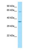 FIG1 / IL4I1 Antibody - FIG1 / IL4I1 antibody Western Blot of HeLa.  This image was taken for the unconjugated form of this product. Other forms have not been tested.