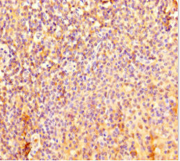 FIG1 / IL4I1 Antibody - Immunohistochemistry of paraffin-embedded human tonsil tissue at dilution 1:100