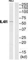 FIG1 / IL4I1 Antibody - Western blot analysis of extracts from HeLa cells, using IL4I1 antibody.