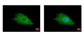 FIG4 Antibody - FIG4 antibody detects FIG4 protein at cytoplasm by immunofluorescent analysis. HeLa cells were fixed in ice-cold MeOH for 5 min. FIG4 protein stained by FIG4 antibody diluted at 1:500.