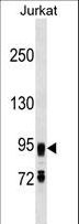 FIG4 Antibody - FIG4 Antibody western blot of Jurkat cell line lysates (35 ug/lane). The FIG4 antibody detected the FIG4 protein (arrow).