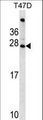 FIGLA Antibody - FIGLA Antibody western blot of T47D cell line lysates (35 ug/lane). The FIGLA antibody detected the FIGLA protein (arrow).