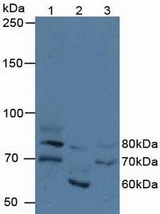 FIGN / Fidgetin Antibody - Western Blot; Sample: Lane1: Human Hela Cells; Lane2: Porcine Kidney Tissue; Lane3: Human 293T Cells.