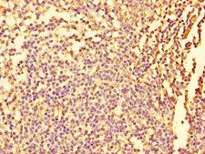 FIGN / Fidgetin Antibody - Immunohistochemistry of paraffin-embedded human tonsil tissue using FIGN Antibody at dilution of 1:100