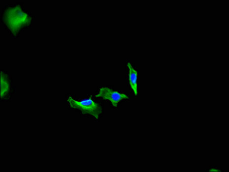 FIGN / Fidgetin Antibody - Immunofluorescent analysis of Hela cells using FIGN Antibody at a dilution of 1:100 and Alexa Fluor 488-congugated AffiniPure Goat Anti-Rabbit IgG(H+L)
