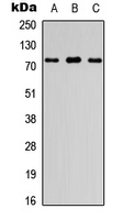 FIGNL1 Antibody - Western blot analysis of FIGNL1 expression in HEK293T (A); Raw264.7 (B); PC12 (C) whole cell lysates.