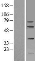 FIGNL1 Protein - Western validation with an anti-DDK antibody * L: Control HEK293 lysate R: Over-expression lysate