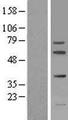 FIGNL1 Protein - Western validation with an anti-DDK antibody * L: Control HEK293 lysate R: Over-expression lysate