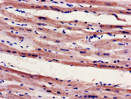 FILIP1 Antibody - Immunohistochemistry of paraffin-embedded human heart tissue using FILIP1 Antibody at dilution of 1:100