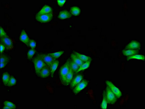 FILIP1 Antibody - Immunofluorescent analysis of HepG2 cells using FILIP1 Antibody at a dilution of 1:100 and Alexa Fluor 488-congugated AffiniPure Goat Anti-Rabbit IgG(H+L)