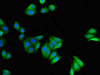 FILIP1 Antibody - Immunofluorescent analysis of HepG2 cells using FILIP1 Antibody at dilution of 1:100 and Alexa Fluor 488-congugated AffiniPure Goat Anti-Rabbit IgG(H+L)