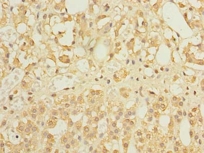 FILIP1L Antibody - Immunohistochemistry of paraffin-embedded human adrenal gland tissue using antibody at dilution of 1:100.