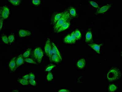 FILIP1L Antibody - Immunofluorescence staining of HepG2 cells with FILIP1L Antibody at 1:166, counter-stained with DAPI. The cells were fixed in 4% formaldehyde, permeabilized using 0.2% Triton X-100 and blocked in 10% normal Goat Serum. The cells were then incubated with the antibody overnight at 4°C. The secondary antibody was Alexa Fluor 488-congugated AffiniPure Goat Anti-Rabbit IgG(H+L).