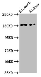 FILIP1L Antibody - Western Blot Positive WB detected in: Rat stomach tissue, Mouse kidney tissue All lanes: FILIP1L antibody at 2.5µg/ml Secondary Goat polyclonal to rabbit IgG at 1/50000 dilution Predicted band size: 131, 103, 30, 100, 80 kDa Observed band size: 131 kDa