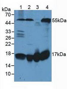 FIS1 Antibody - Western Blot; Sample: Lane1: Human Lung Tissue; Lane2: Human Hela Cells; Lane3: Rat Heart Tissue; Lane4: Rat Brain Tissue.