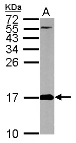FIS1 Antibody - Sample (50 ug of whole cell lysate). A: mouse brain. 15% SDS PAGE. FIS1 antibody diluted at 1:5000.