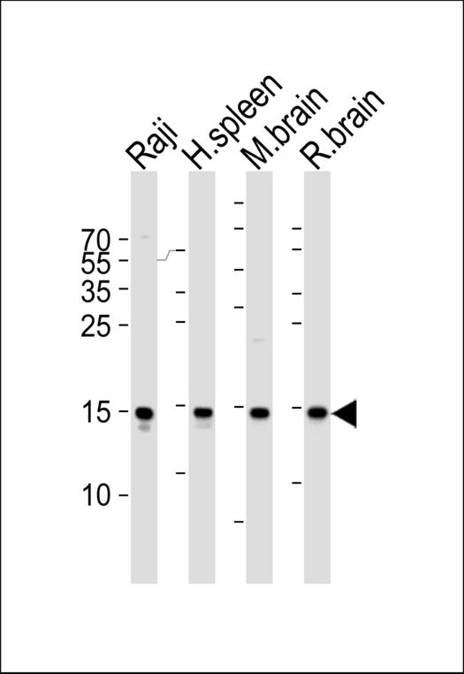FIS1 Antibody - Western blot of lysates from Raji cell line, human spleen, mouse brain and rat brain tissue lysate (from left to right) with FIS1 Antibody. Antibody was diluted at 1:1000 at each lane. A goat anti-rabbit IgG H&L (HRP) at 1:5000 dilution was used as the secondary antibody. Lysates at 35 ug per lane.