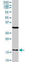 FIS1 Antibody - FIS1 monoclonal antibody (M01), clone 1G9. Western blot of FIS1 expression in human liver.