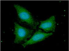 FIS1 Antibody - ICC/IF analysis of TTC11 in HaLa cells. The cell was stained with TTC11 antibody (1:100).The secondary antibody (green) was used Alexa Fluor 488. DAPI was stained the cell nucleus (blue).