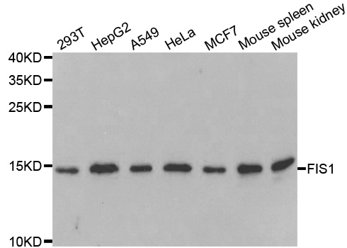 FIS1 Antibody - Western blot analysis of extracts of various cell lines.