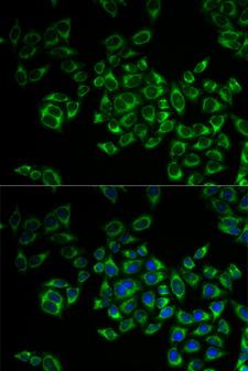 FIS1 Antibody - Immunofluorescence analysis of MCF-7 cells.