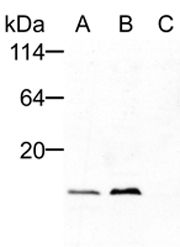 FIS1 Antibody - Detection of endogenous Fis1 by Western blot (1:1000) using anti-Fis1, pAb . .Method: 10 ug mitochondrial proteins from mouse brain (A) and kidney (B); 10 ug cytosolic proteins from mouse liver (C).