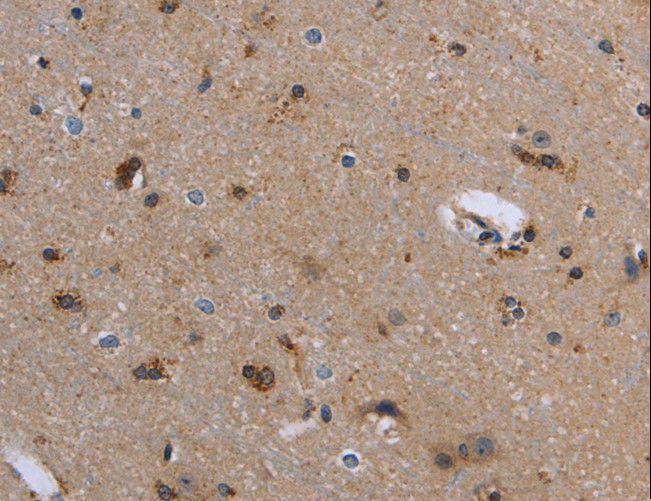 FIS1 Antibody - Immunohistochemistry of paraffin-embedded Human brain using FIS1 Polyclonal Antibody at dilution of 1:20.