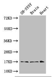 FIS1 Antibody - Positive WB detected in:SH-SY5Y whole cell lysate,Mouse brain tissue,Mouse heart tissue;All lanes: FIS1 antibody at 3ug/ml;Secondary;Goat polyclonal to rabbit IgG at 1/50000 dilution;Predicted band size: 17 kDa;Observed band size: 17 kDa;