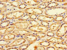 FIS1 Antibody - Immunohistochemistry of paraffin-embedded human kidney tissue using FIS1 Antibody at dilution of 1:100
