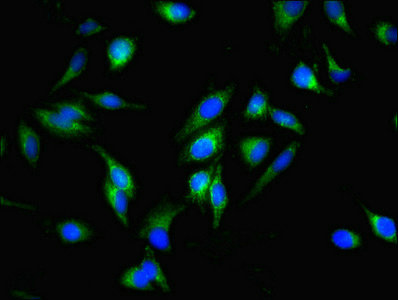 FIS1 Antibody - Immunofluorescent analysis of Hela cells using FIS1 Antibody at dilution of 1:100 and Alexa Fluor 488-congugated AffiniPure Goat Anti-Rabbit IgG(H+L)