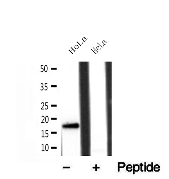 FIS1 Antibody - Western blot analysis of extracts of HeLa cells using FIS1 antibody.