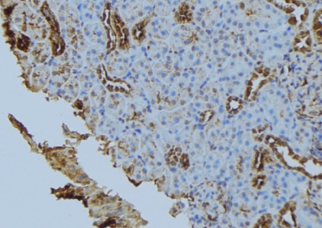 FIS1 Antibody - 1:100 staining mouse kidney tissue by IHC-P. The sample was formaldehyde fixed and a heat mediated antigen retrieval step in citrate buffer was performed. The sample was then blocked and incubated with the antibody for 1.5 hours at 22°C. An HRP conjugated goat anti-rabbit antibody was used as the secondary.